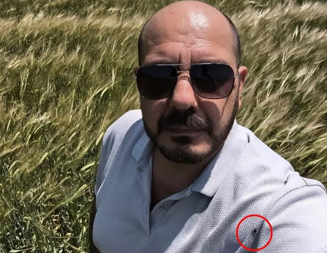 Çektiği selfie hayatını kurtardı! Fotoğrafta gördükleri karşısında şoke oldu: Tam 20-25 tane… Çektiği selfie hayatını kurtardı! Fotoğrafta gördükleri karşısında şoke oldu: Tam 20-25 tane… - 3. Resim