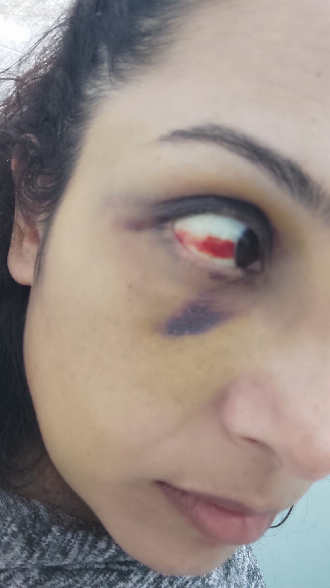 Öğretmen Burcu evlendiği günden beri boşanmaya çalışıyor... Kabus gibi hayat! MEB bile devreye girdi Öğretmen Burcu evlendiği günden beri boşanmaya çalışıyor... Kabus gibi hayat! MEB bile devreye girdi - 3. Resim