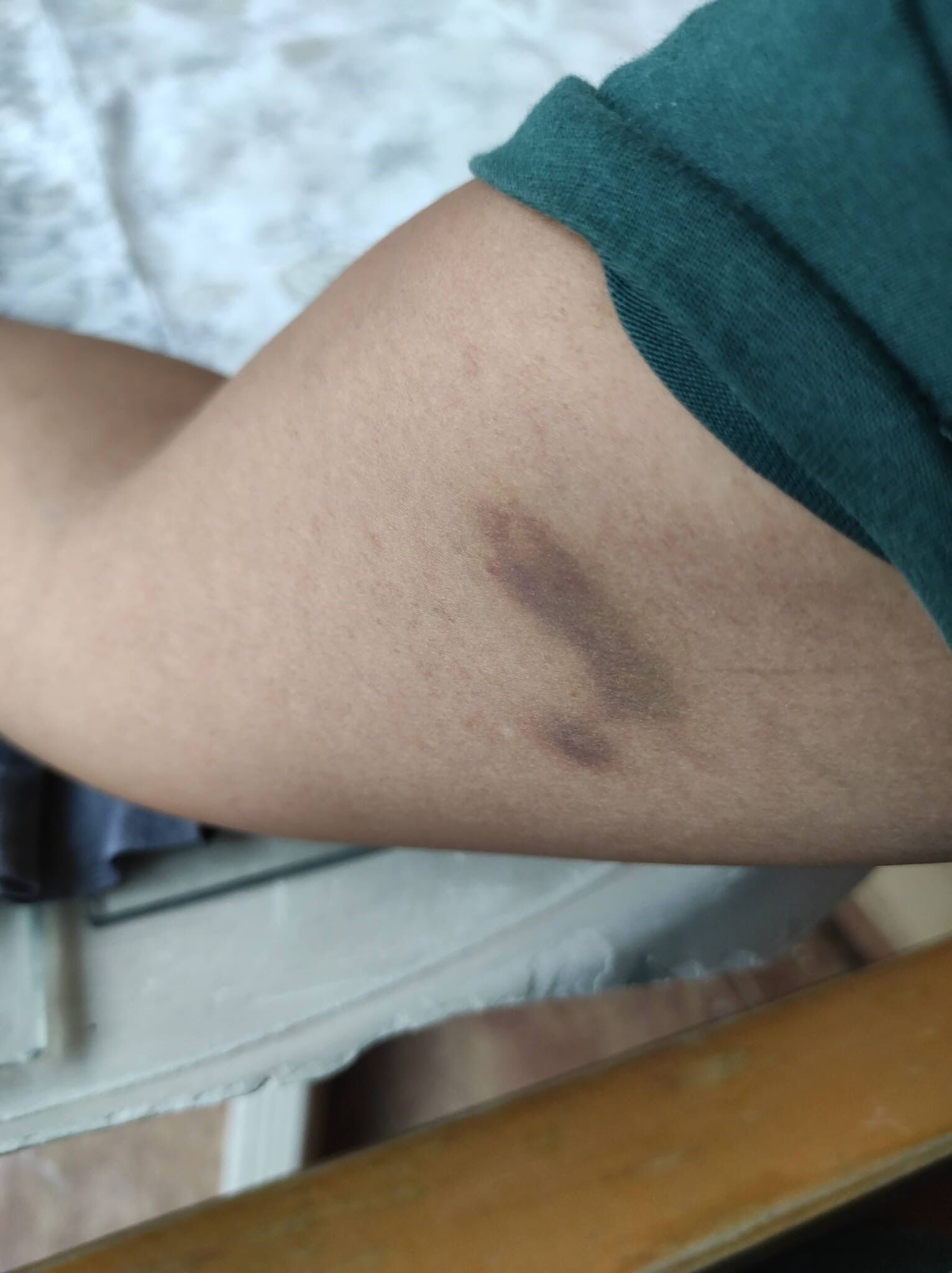 Öğretmen Burcu evlendiği günden beri boşanmaya çalışıyor... Kabus gibi hayat! MEB bile devreye girdi Öğretmen Burcu evlendiği günden beri boşanmaya çalışıyor... Kabus gibi hayat! MEB bile devreye girdi - 2. Resim