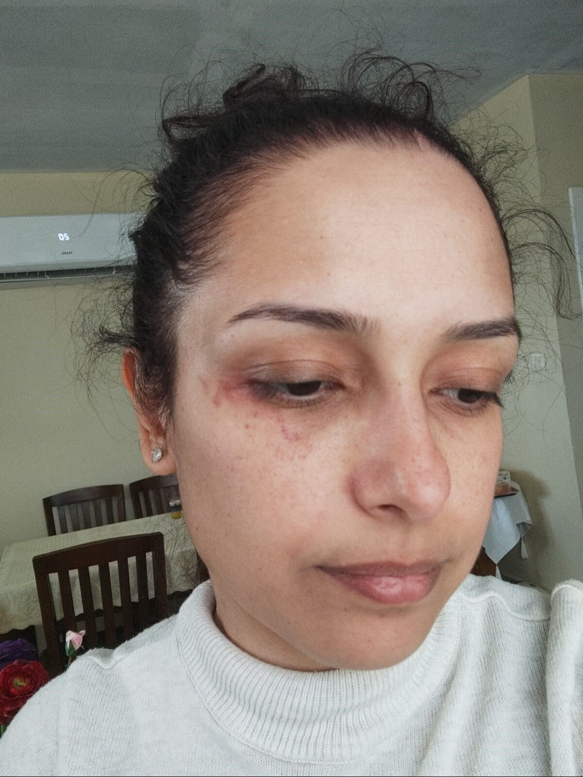Öğretmen Burcu evlendiği günden beri boşanmaya çalışıyor... Kabus gibi hayat! MEB bile devreye girdi Öğretmen Burcu evlendiği günden beri boşanmaya çalışıyor... Kabus gibi hayat! MEB bile devreye girdi - 1. Resim