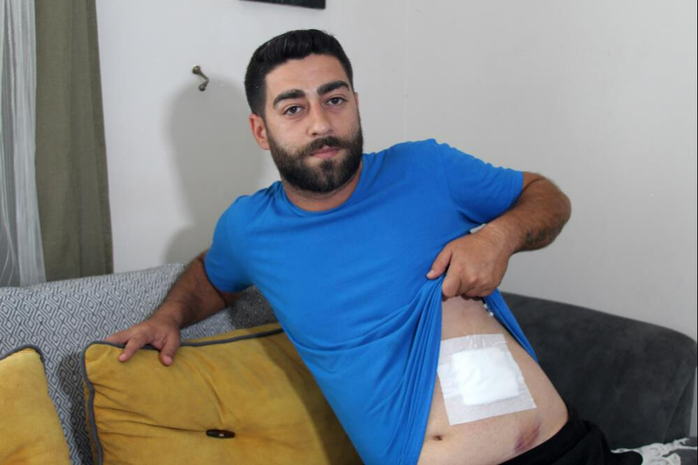 Ailesiyle bayramlaşmaya gitti, dehşeti yaşadı! "Kanamayı görünce vurulduğumu anladım" Ailesiyle bayramlaşmaya gitti, dehşeti yaşadı! "Kanamayı görünce vurulduğumu anladım" - 3. Resim