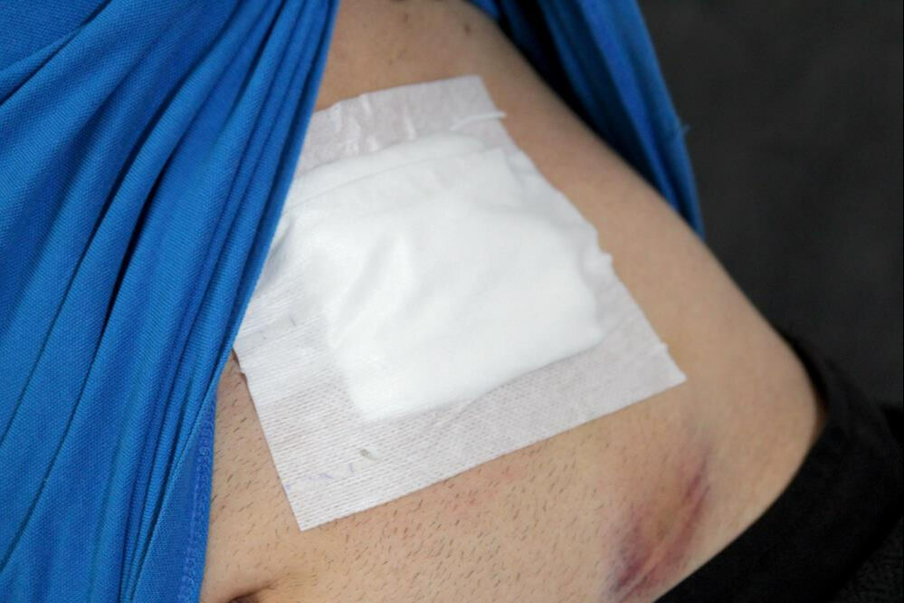 Ailesiyle bayramlaşmaya gitti, dehşeti yaşadı! "Kanamayı görünce vurulduğumu anladım" Ailesiyle bayramlaşmaya gitti, dehşeti yaşadı! "Kanamayı görünce vurulduğumu anladım" - 2. Resim