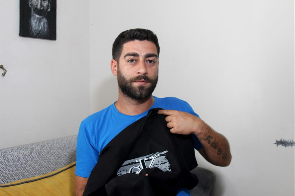 Ailesiyle bayramlaşmaya gitti, dehşeti yaşadı! "Kanamayı görünce vurulduğumu anladım" Ailesiyle bayramlaşmaya gitti, dehşeti yaşadı! "Kanamayı görünce vurulduğumu anladım" - 1. Resim