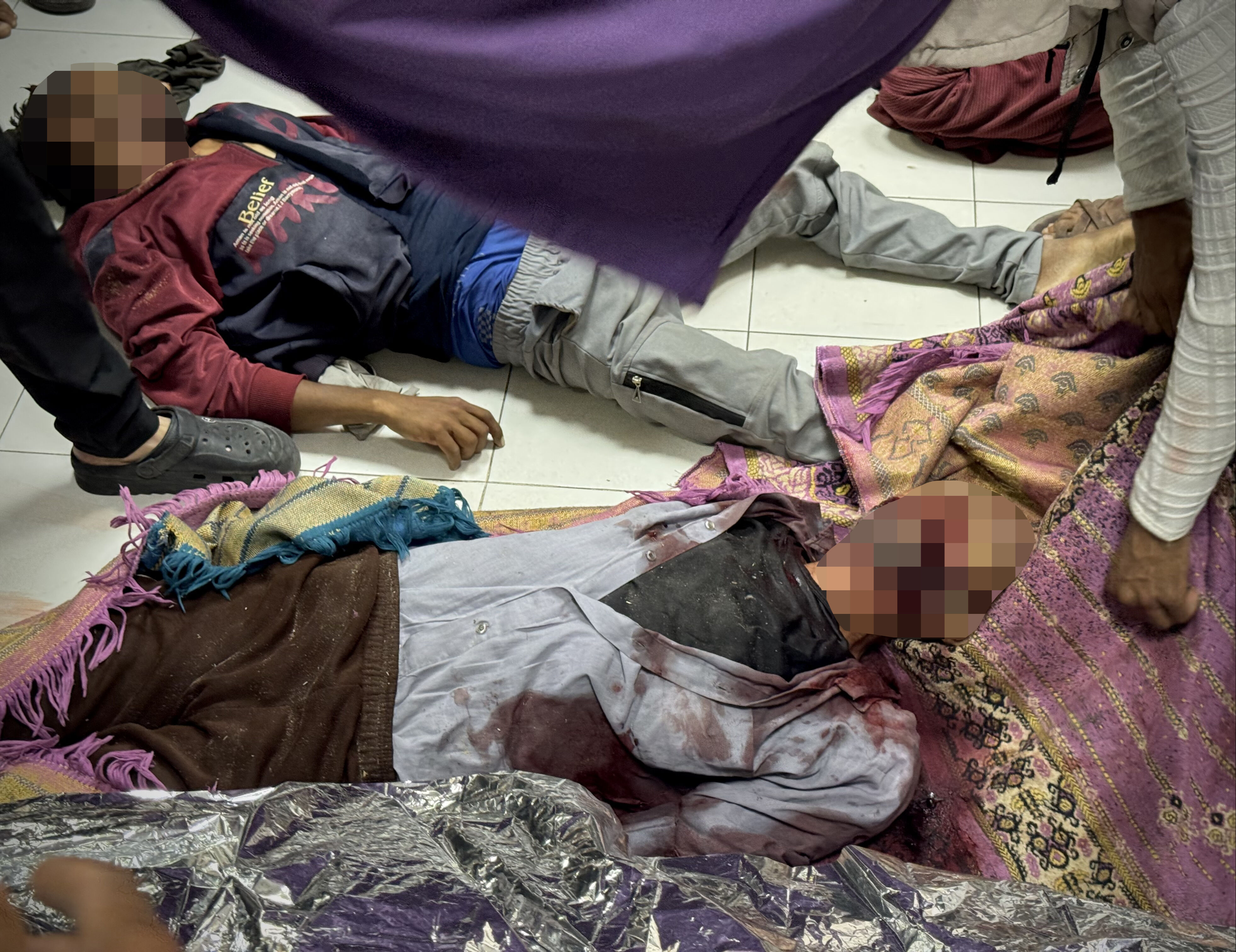 Çocuklarına bir lokma ekmek arıyorlardı! Yardım bekleyen sivillerin üstüne ateş açıldı, 62 ölü Çocuklarına bir lokma ekmek arıyorlardı! Yardım bekleyen sivillerin üstüne ateş açıldı, 62 ölü - 2. Resim