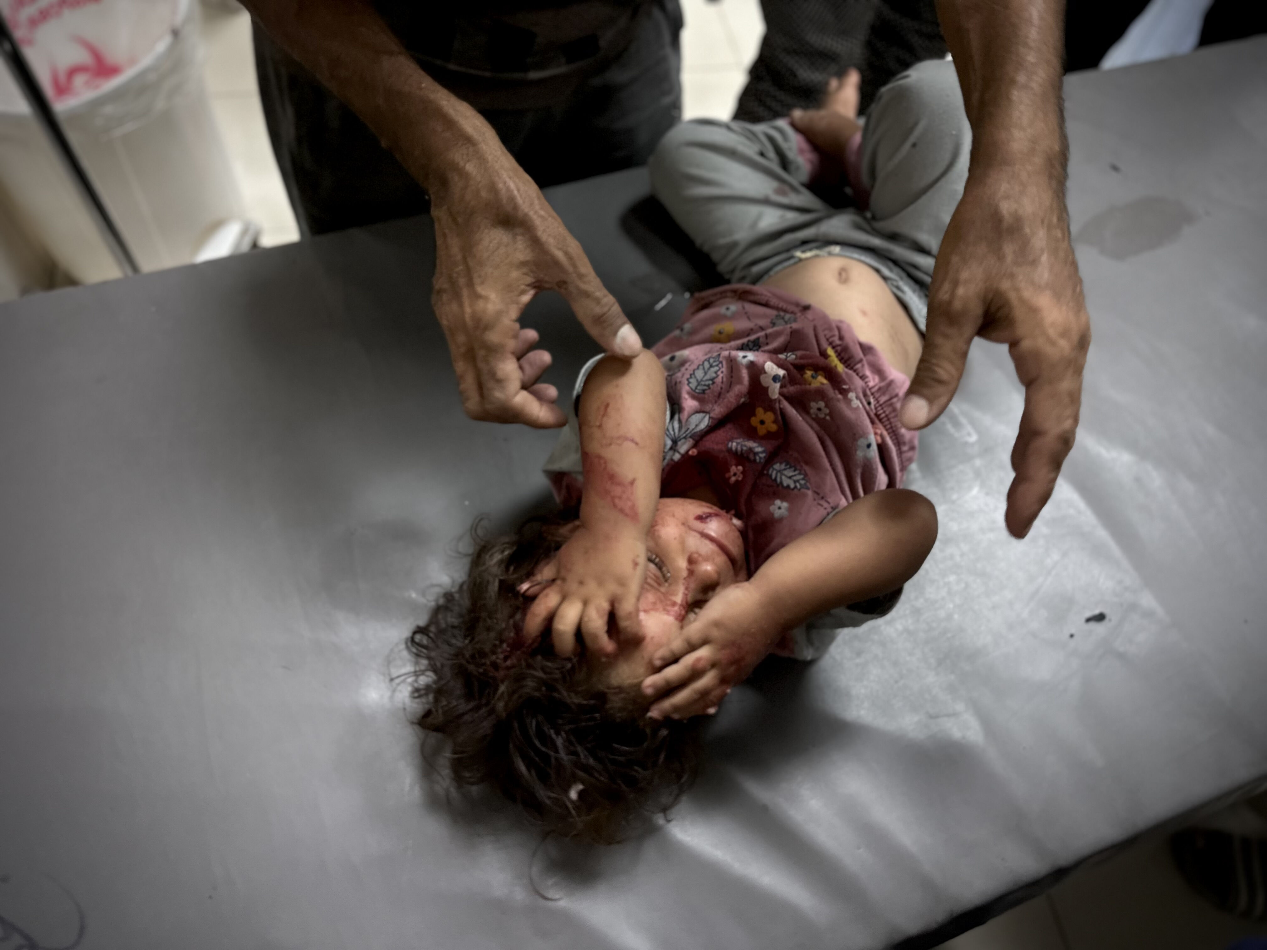 Çocuklarına bir lokma ekmek arıyorlardı! Yardım bekleyen sivillerin üstüne ateş açıldı, 62 ölü Çocuklarına bir lokma ekmek arıyorlardı! Yardım bekleyen sivillerin üstüne ateş açıldı, 62 ölü - 4. Resim