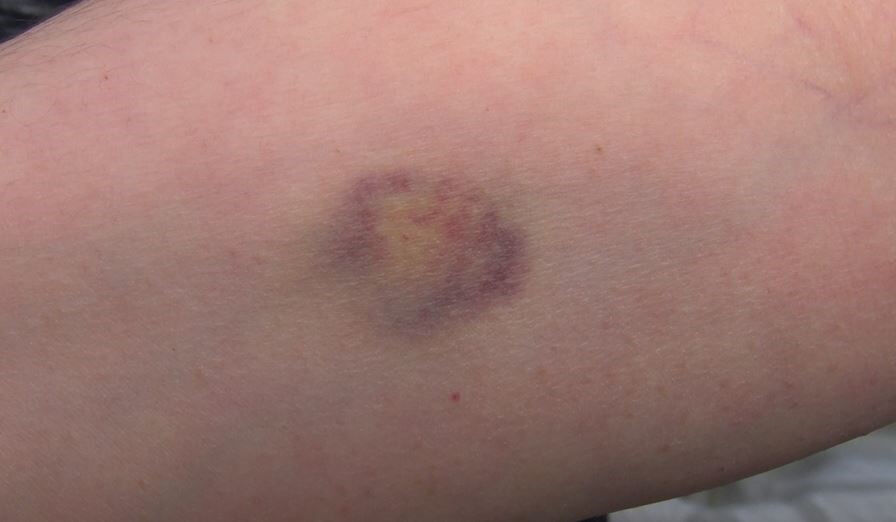 Çöp tartışması kavgaya döndü! Bayram günü faciayı yaşadı... ''Senin gibi itle muhatap olmayız'' - 2. Resim