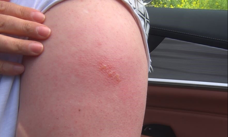 Çöp tartışması kavgaya döndü! Bayram günü faciayı yaşadı... ''Senin gibi itle muhatap olmayız'' - 1. Resim