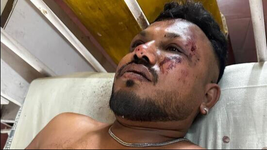 11A'da hayata tutundu! Hindistan uçağından sağ çıkan adam: Her taraf ceset doluydu 11A'da hayata tutundu! Hindistan uçağından sağ çıkan adam: Her taraf ceset doluydu - 1. Resim