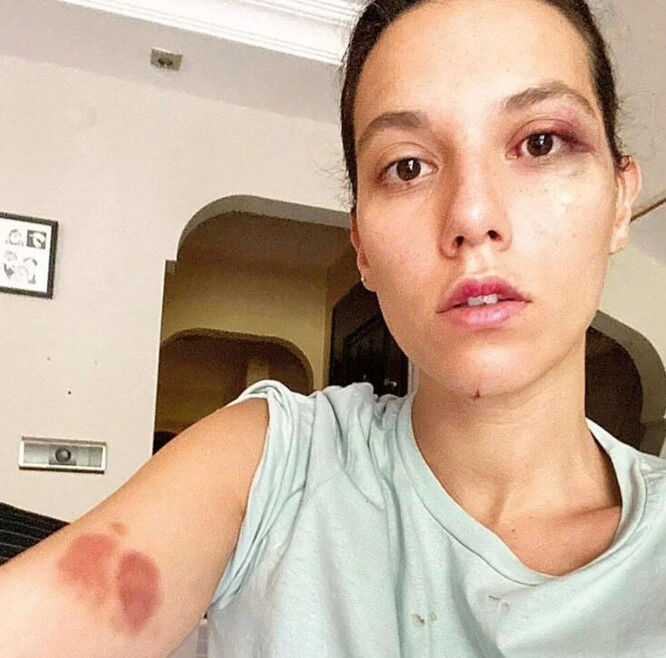 Deniz Bulutsuz kimdir? Ozan Güven Deniz Bulutsuz olayı Deniz Bulutsuz kimdir? Ozan Güven Deniz Bulutsuz olayı - 1. Resim