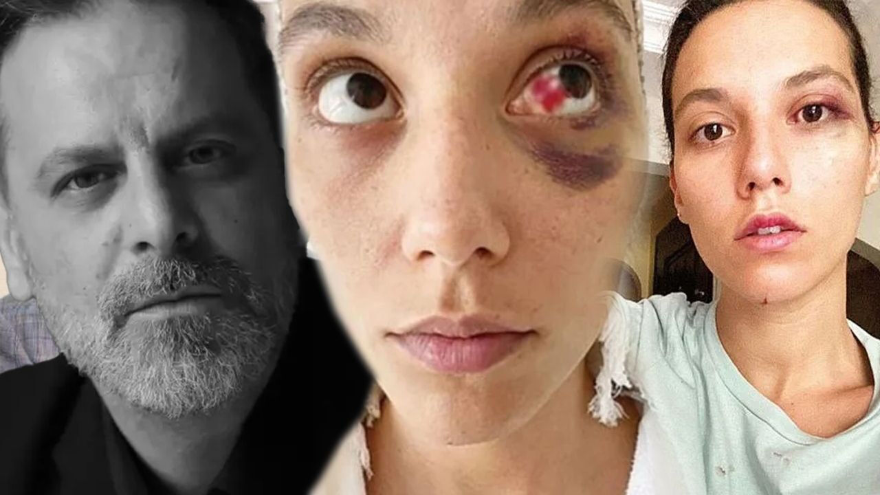 Oyuncu Ozan Güven'e hapis cezası! - 3. Resim