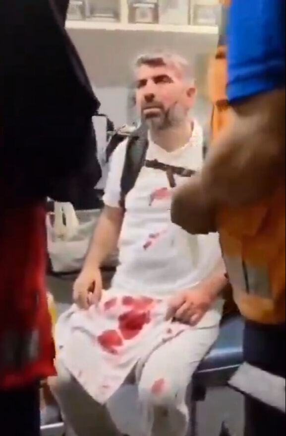 Uluslararası Refah Yürüyüşüne katılmıştı! HÜDA-PAR Milletvekili Faruk Dinç başından yaralandı - 1. Resim