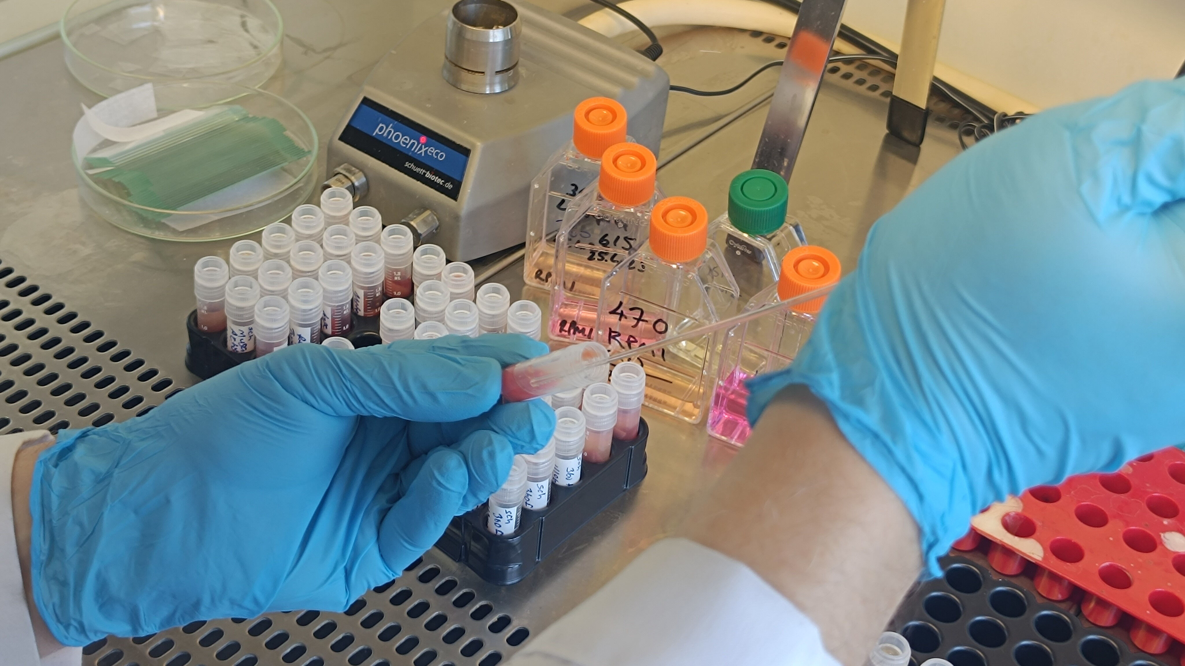 Yaraya benziyor ama öldürebiliyor! Sinsi tehlike “Yakarca” sineği o illerde görülüyor - 3. Resim