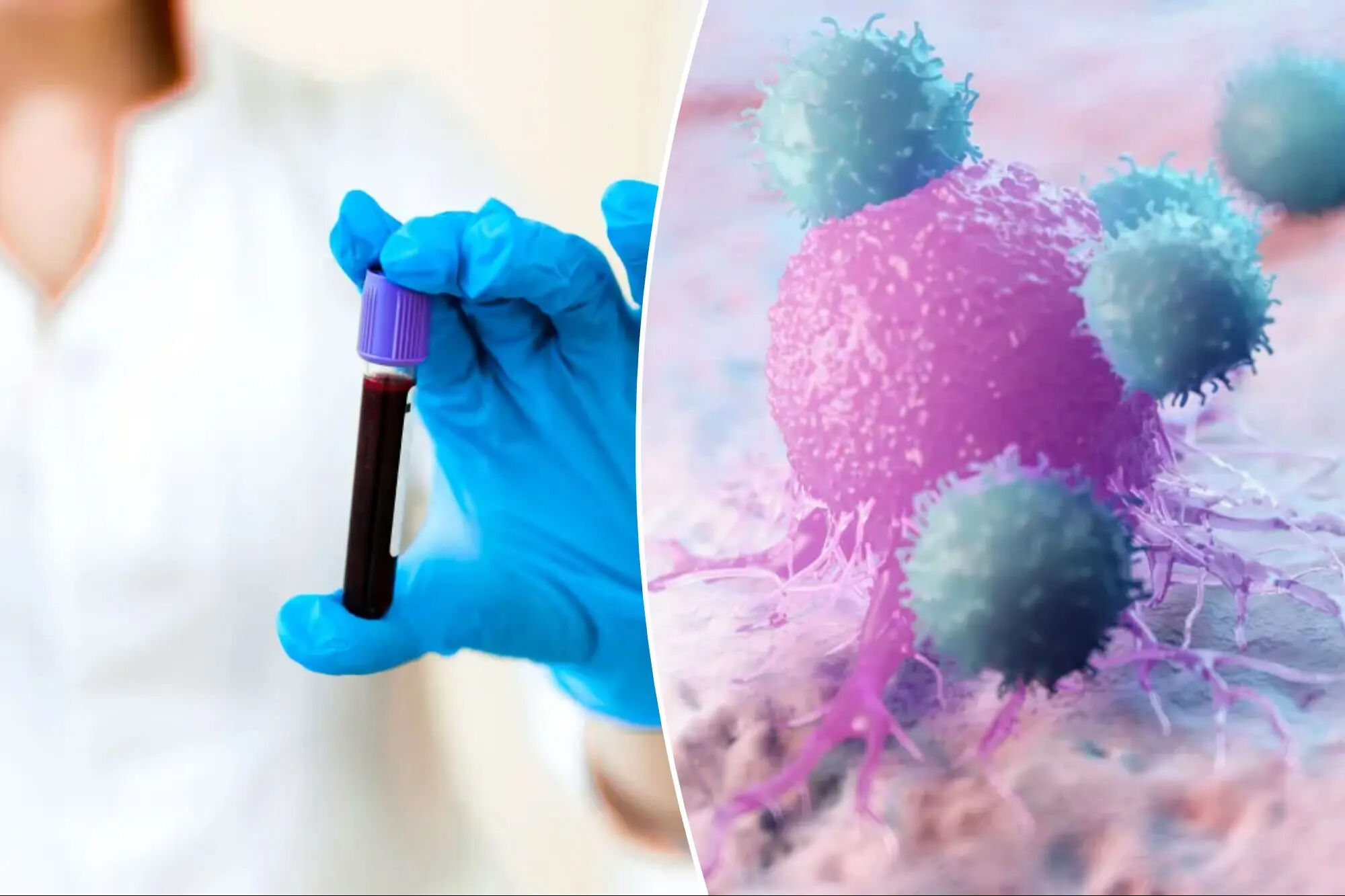 Kanseri 3 yıl önceden tespit eden kan testi geliştirildi! - 1. Resim