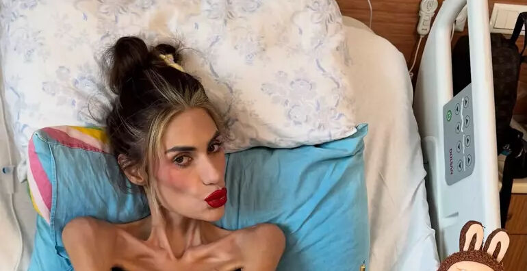 Anoreksiya hastaları neden yemek yemez? Nihal Candan’ın hastalığı ve yemeyi reddetme sebebi Anoreksiya hastaları neden yemek yemez? Nihal Candan’ın hastalığı ve yemeyi reddetme sebebi - 3. Resim