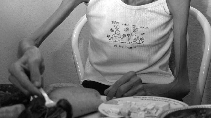 Anoreksiya Nervoza ölüm oranı! Belirtileri ve tedavisi nelerdir? Anoreksiya Nervoza ölüm oranı! Belirtileri ve tedavisi nelerdir? - 2. Resim