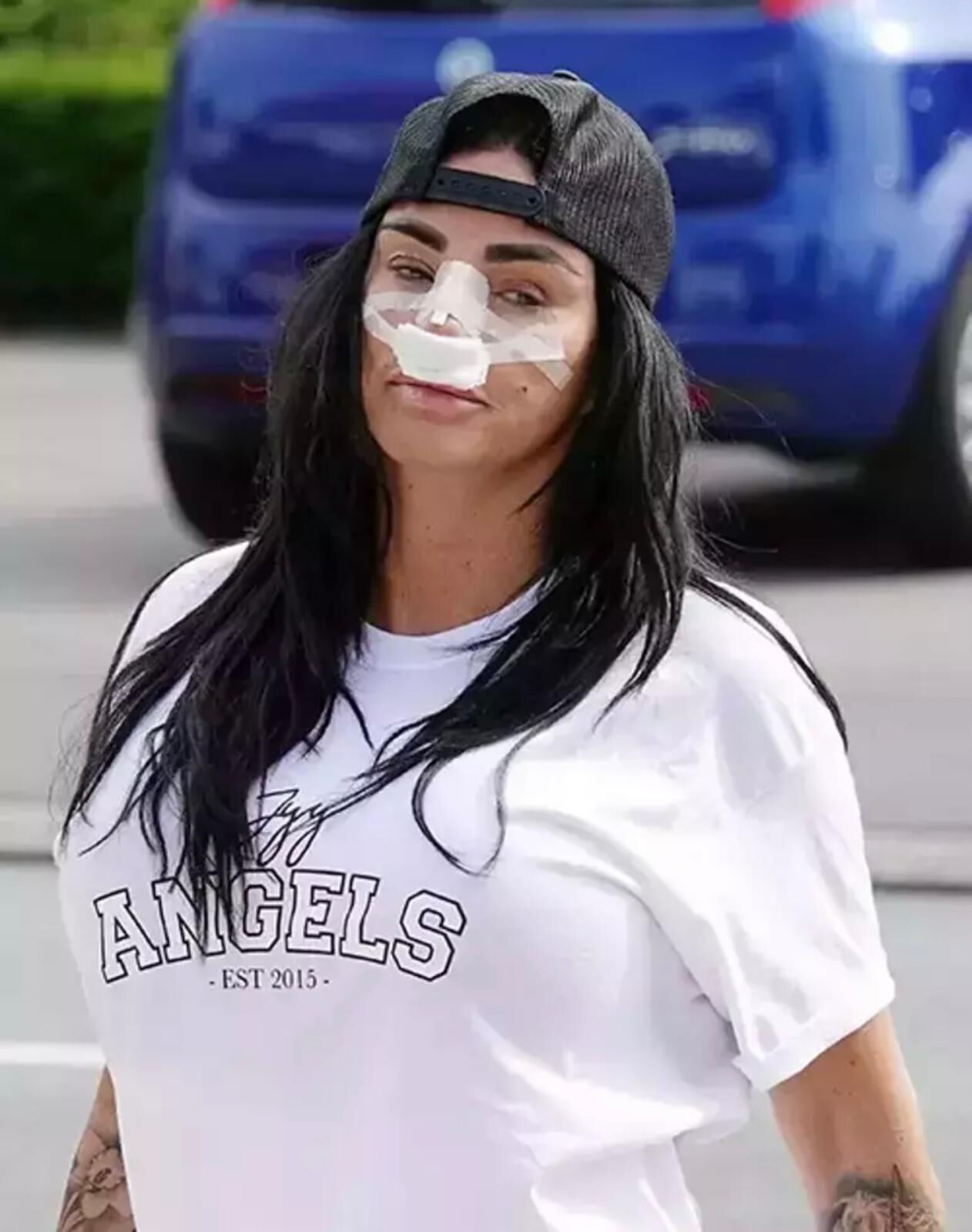 Genç kızları felakete sürüklüyor! Estetik bağımlılığı arttı Genç kızlar dikkat! Estetik bağımlılığı arttı! - 2. Resim