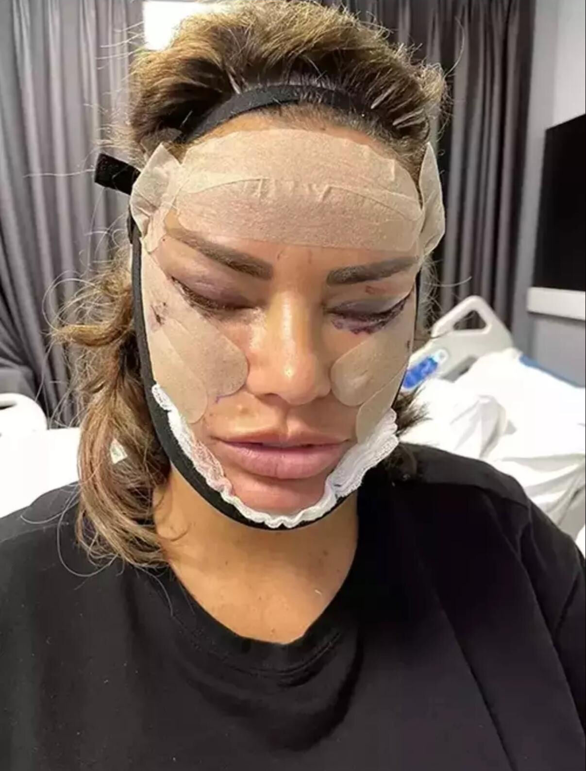 Genç kızları felakette sürüklüyor! Estetik bağımlılığı arttı! Genç kızlar dikkat! Estetik bağımlılığı arttı! - 1. Resim