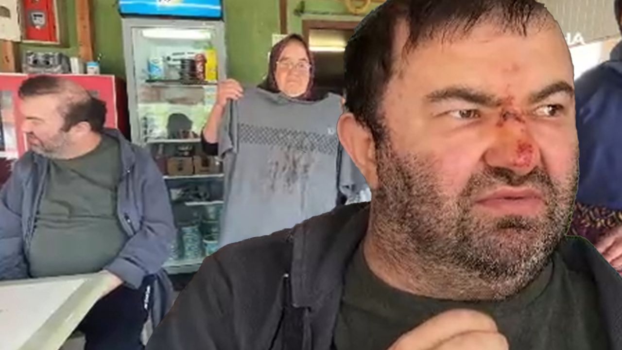 Bu şiddetin mazereti yok! Engelli adamı acımasızca darbetti Bu şiddetin mazereti yok! Engelli adamı acımasızca darbetti