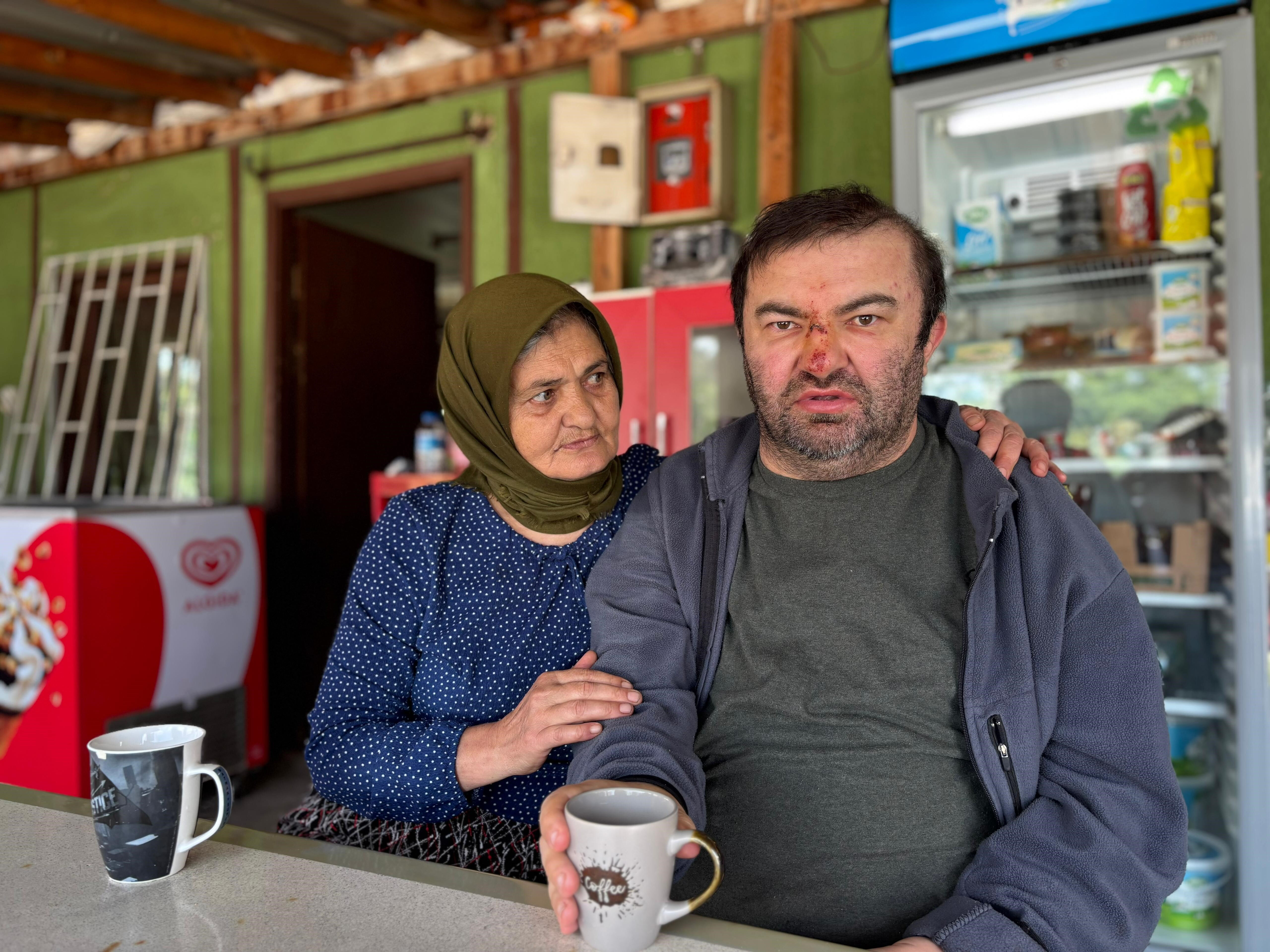 Bu şiddetin mazereti yok! Engelli adamı acımasızca darbetti Bu şiddetin mazereti yok! Engelli adamı acımasızca darbetti - 1. Resim