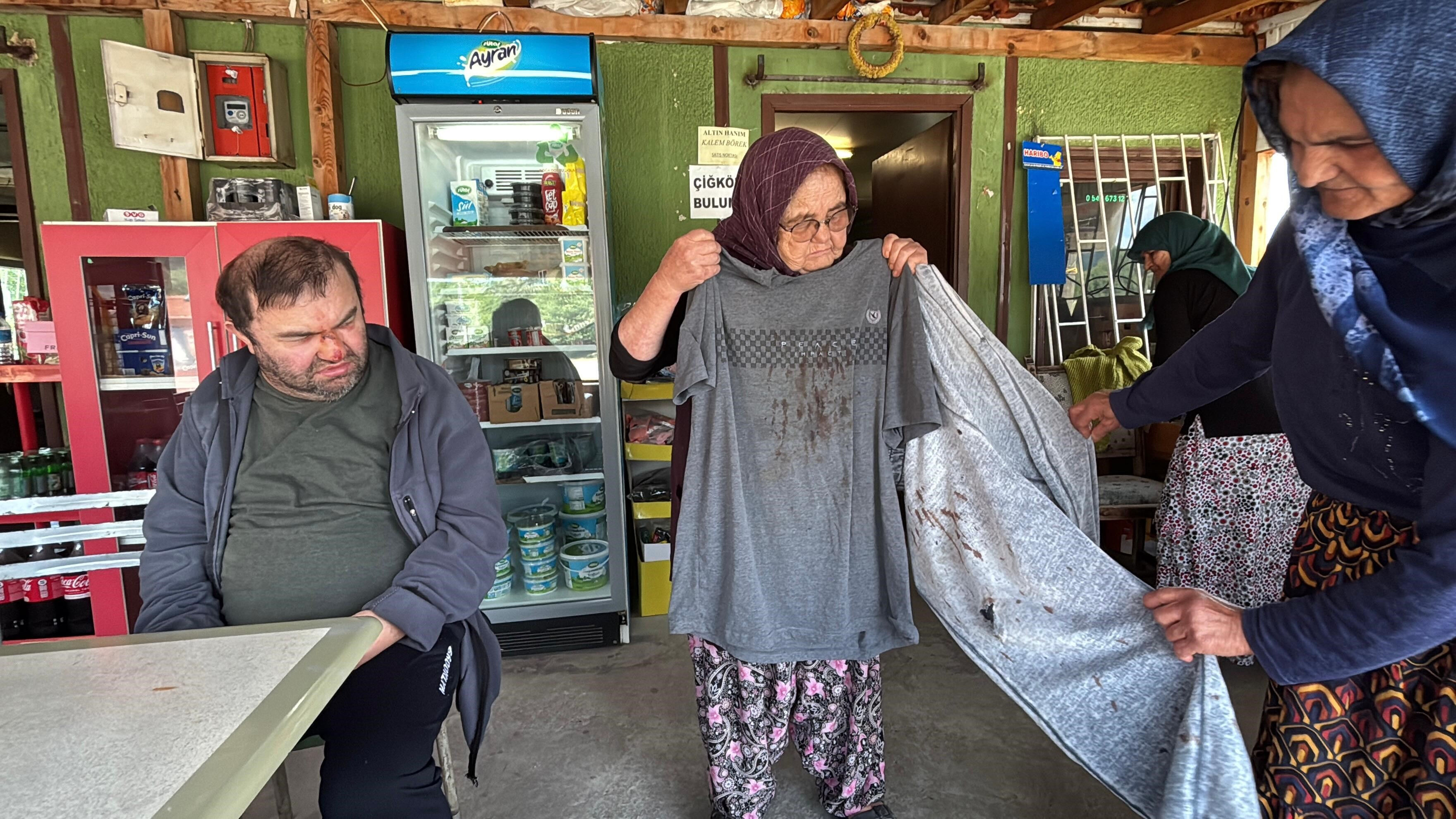 Bu şiddetin mazereti yok! Engelli adamı acımasızca darbetti Bu şiddetin mazereti yok! Engelli adamı acımasızca darbetti - 2. Resim