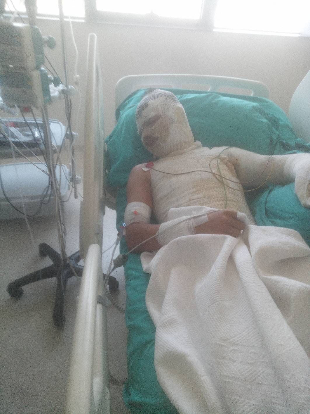 Adana'da aile içinde kan donduran plan! 16 yaşındaki yeğenini yakan adamın yalanı pes dedirtti - 2. Resim