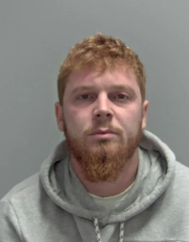 Vahşetin böylesi! Kız arkadaşının kaşını ısırarak koparttı: Sebebi ise kan dondurdu - 1. Resim