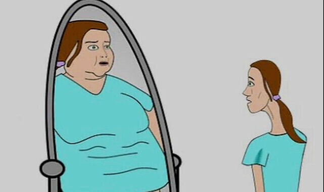 Nihal Candan 23 kiloya düşmüştü! Uzmandan anoreksiya nervoza uyarısı: Kız çocuklarında risk büyük - 2. Resim