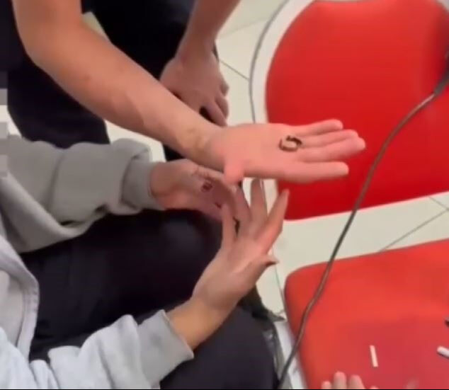 Parmakta sıkışan yüzük hastanelik etti! İtfaiye yardımına koştu - 2. Resim