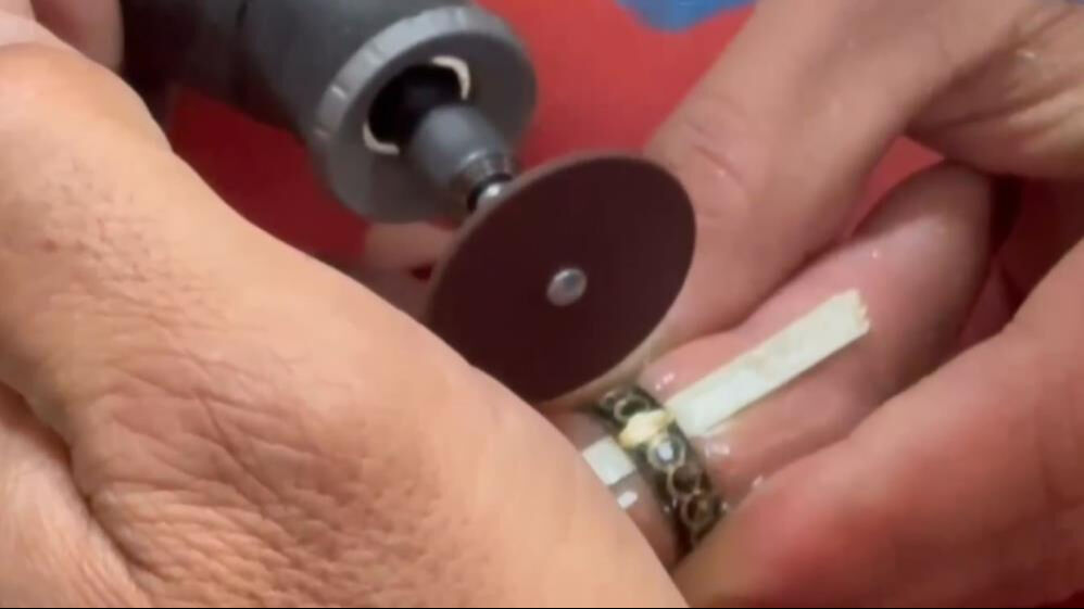 Parmakta sıkışan yüzük hastanelik etti! İtfaiye yardımına koştu - 1. Resim