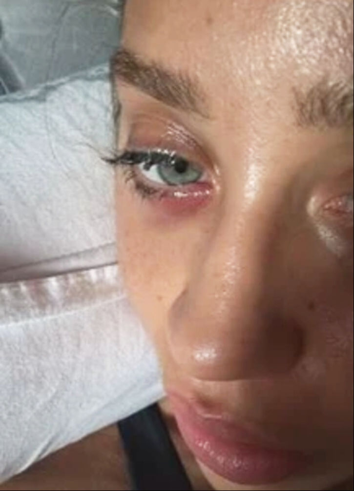 Hamdi Alkan'ın kızı Zeynep Alkan'dan korkutan haber! Ameliyat oldu Hamdi Alkan'ın kızı Zeynep Alkan'dan korkutan haber! Ameliyat oldu - 3. Resim