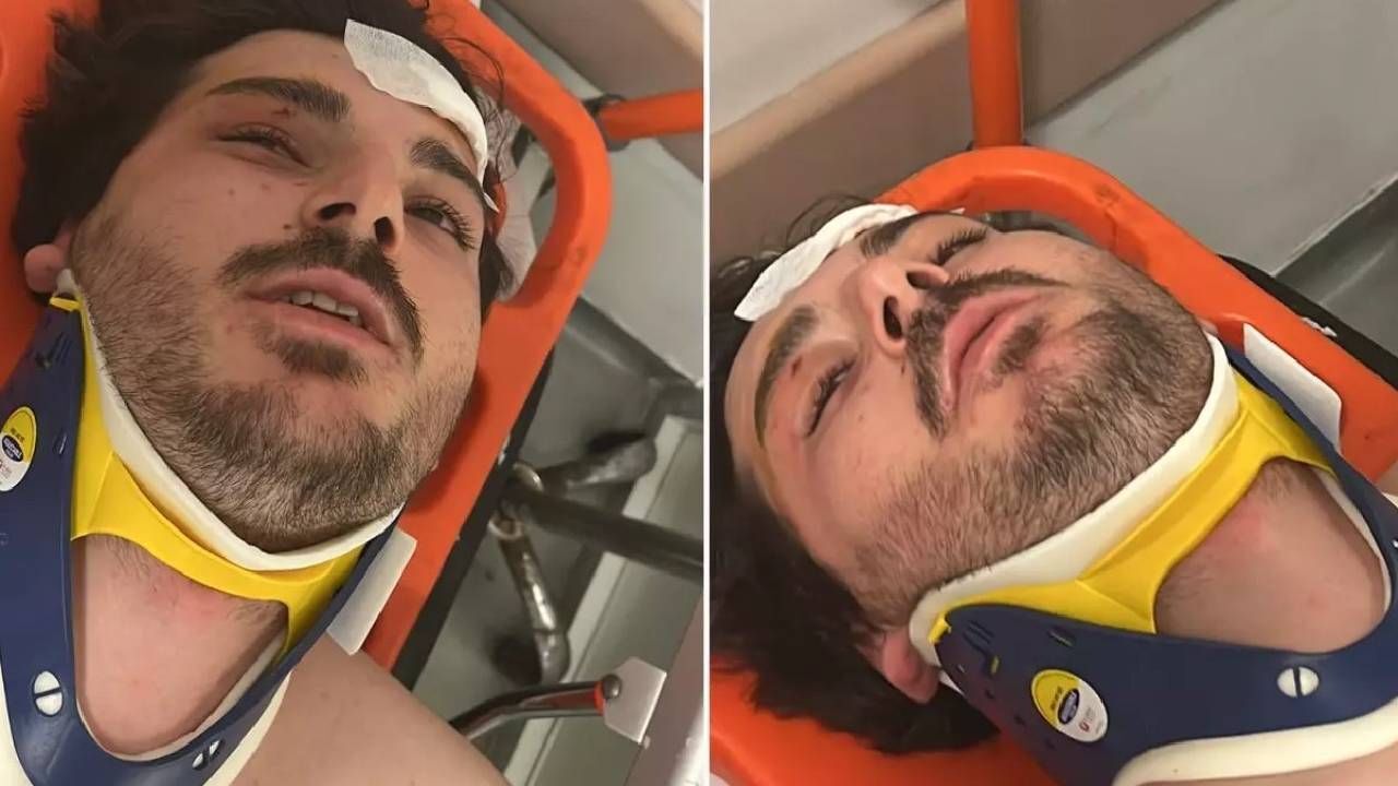 Otobanda durduruldu, feci şekilde darbedildi! Oyuncu Mehmet Akif Akdeniz’den kan donduran açıklama Otobanda durduruldu, feci şekilde darbedildi! Oyuncu Mehmet Akif Akdeniz’den kan donduran açıklama