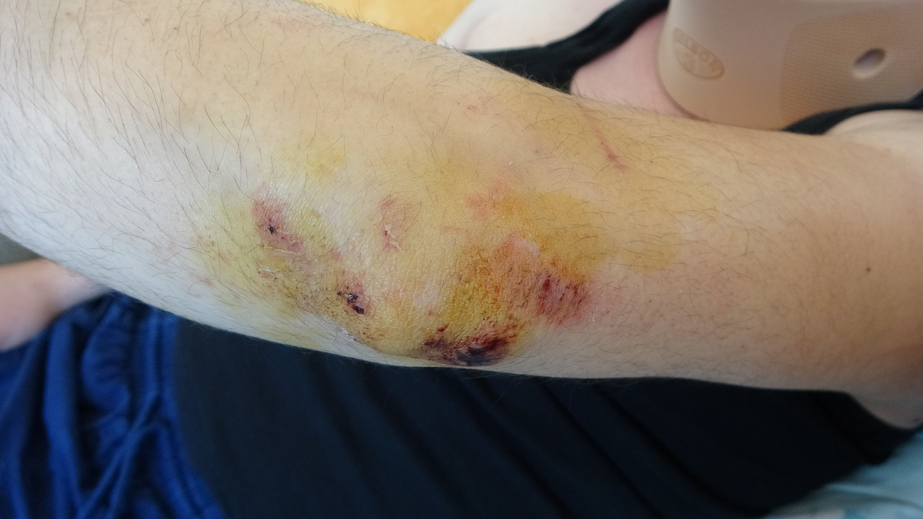 Trafikte ölümden döndü! Oyuncu Mehmet Akif Akdeniz'in annesi konuştu: Trafikte ölümden döndü! Oyuncu Mehmet Akif Akdeniz'in annesi konuştu: