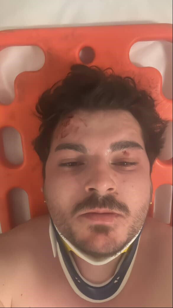 Trafikte saldırıya uğradı! Oyuncu Mehmet Akif Akdeniz dehşet anları anlattı - 1. Resim