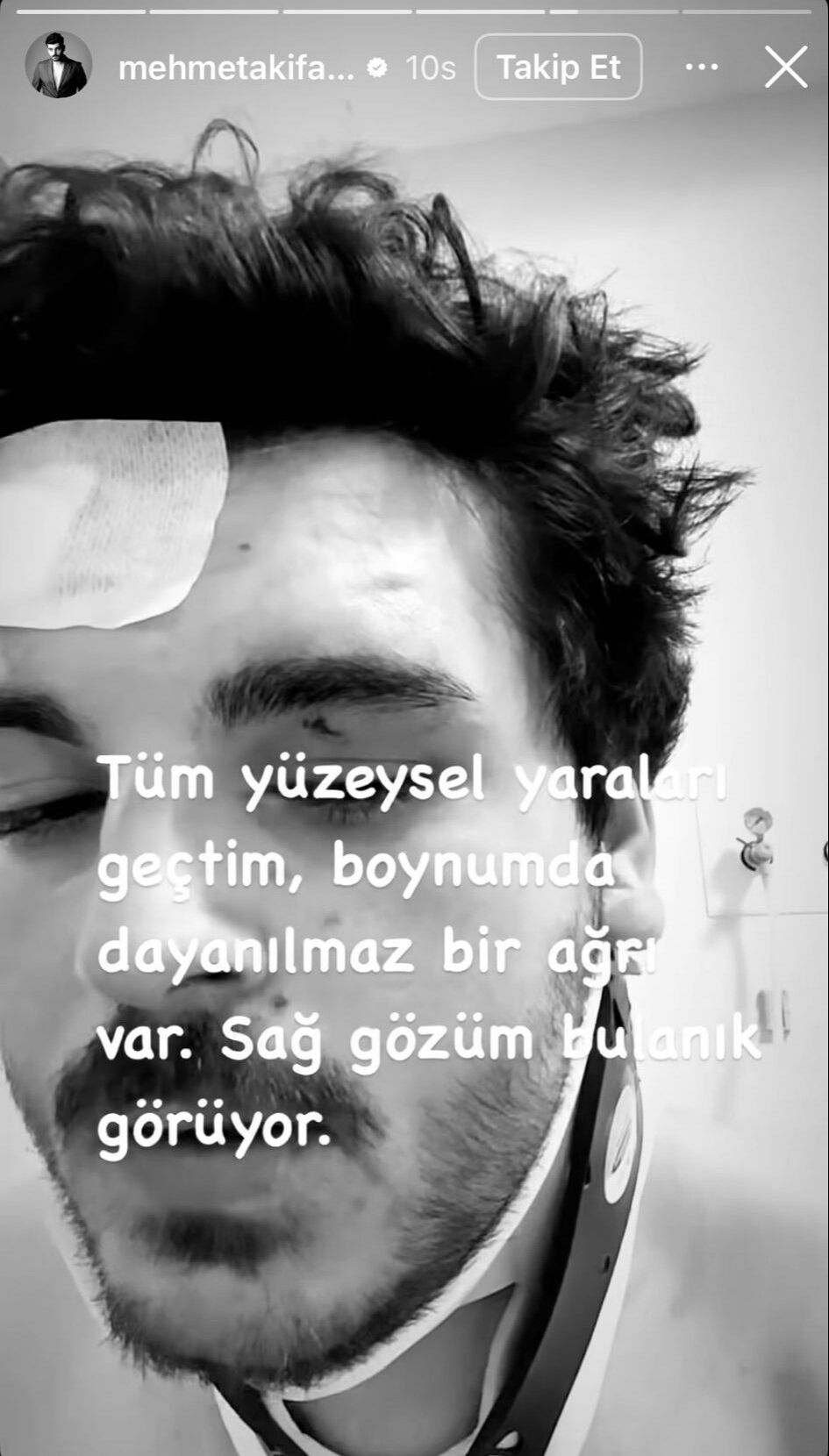 Trafikte saldırıya uğradı! Oyuncu Mehmet Akif Akdeniz dehşet anları anlattı - 3. Resim