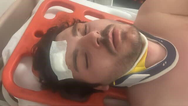 Trafikte saldırıya uğradı! Oyuncu Mehmet Akif Akdeniz dehşet anları anlattı - 4. Resim