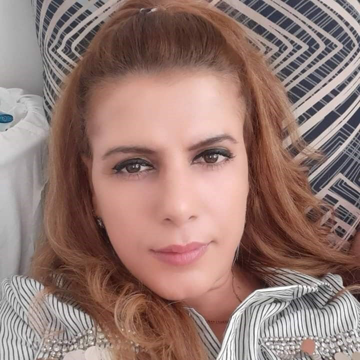 Uyurken yüzüne kezzap atıldı! Gözü akan, kıkırdakları eriyen kadının hayatı kabusa döndü - 1. Resim