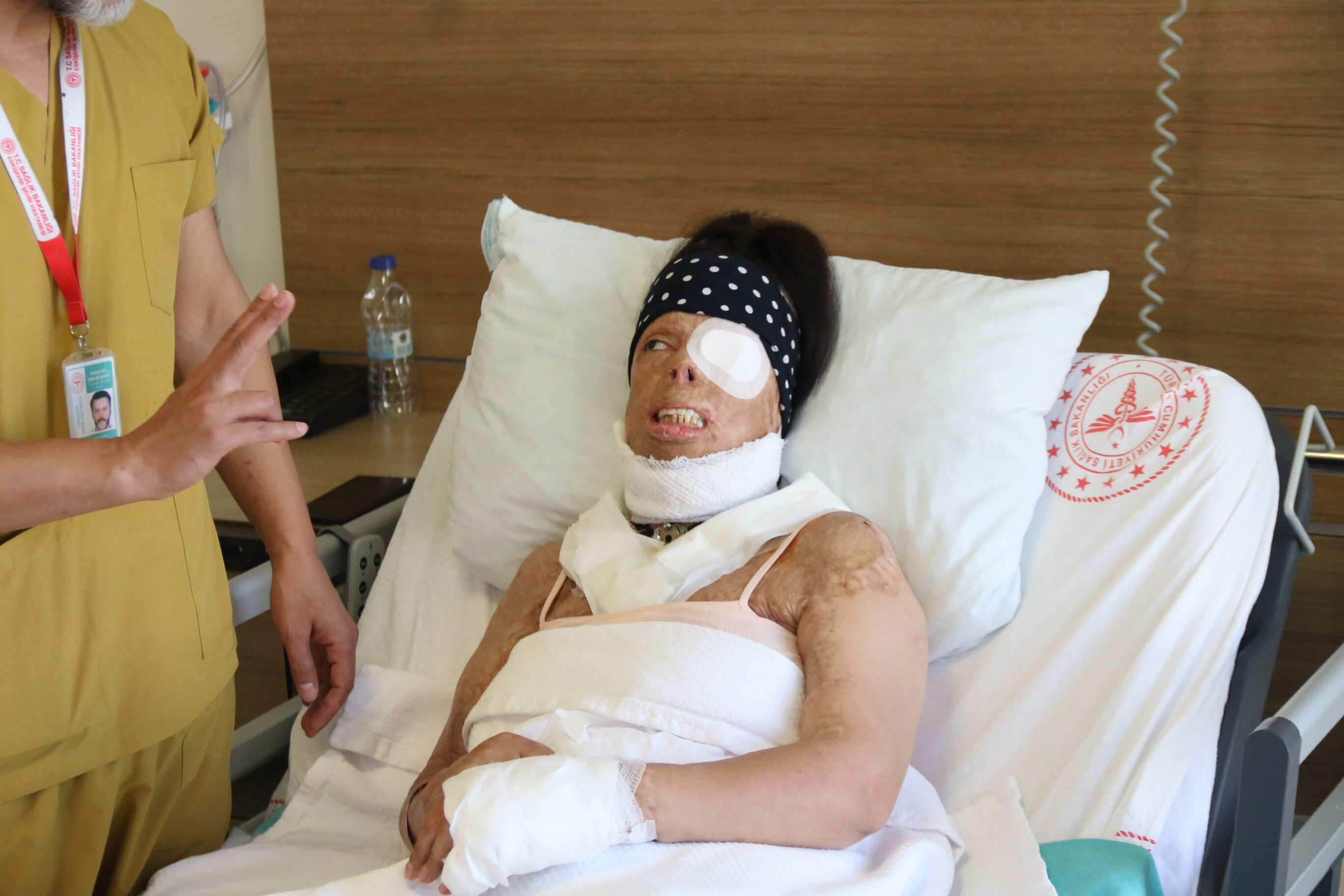 Uyurken yüzüne kezzap atıldı! Gözü akan, kıkırdakları eriyen kadının hayatı kabusa döndü - 3. Resim