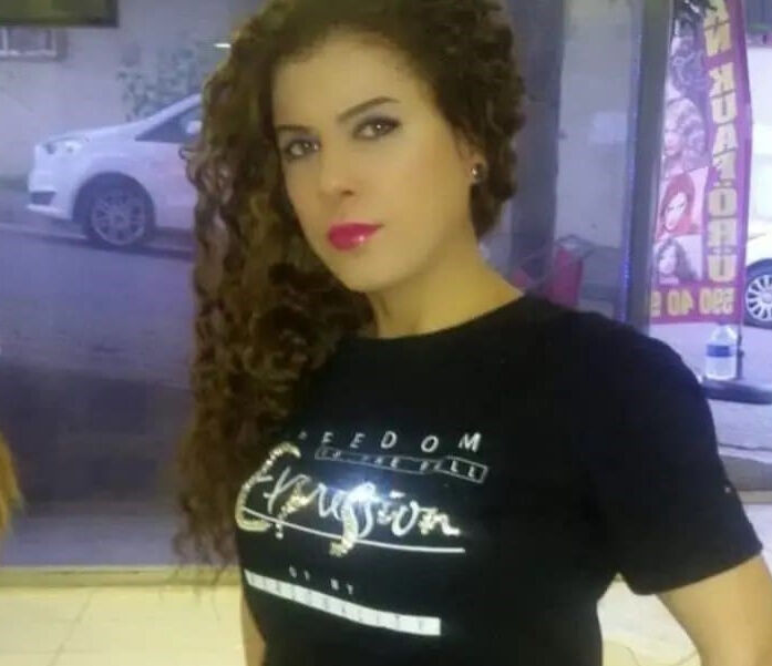 Uyurken yüzüne kezzap atıldı! Gözü akan, kıkırdakları eriyen kadının hayatı kabusa döndü - 2. Resim