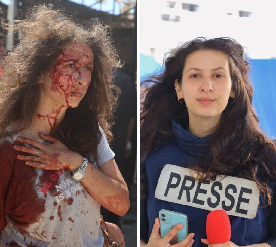 Savaş uçakları plajı bombaladı! Katliam saldırısında çok sayıda ölü var - 2. Resim