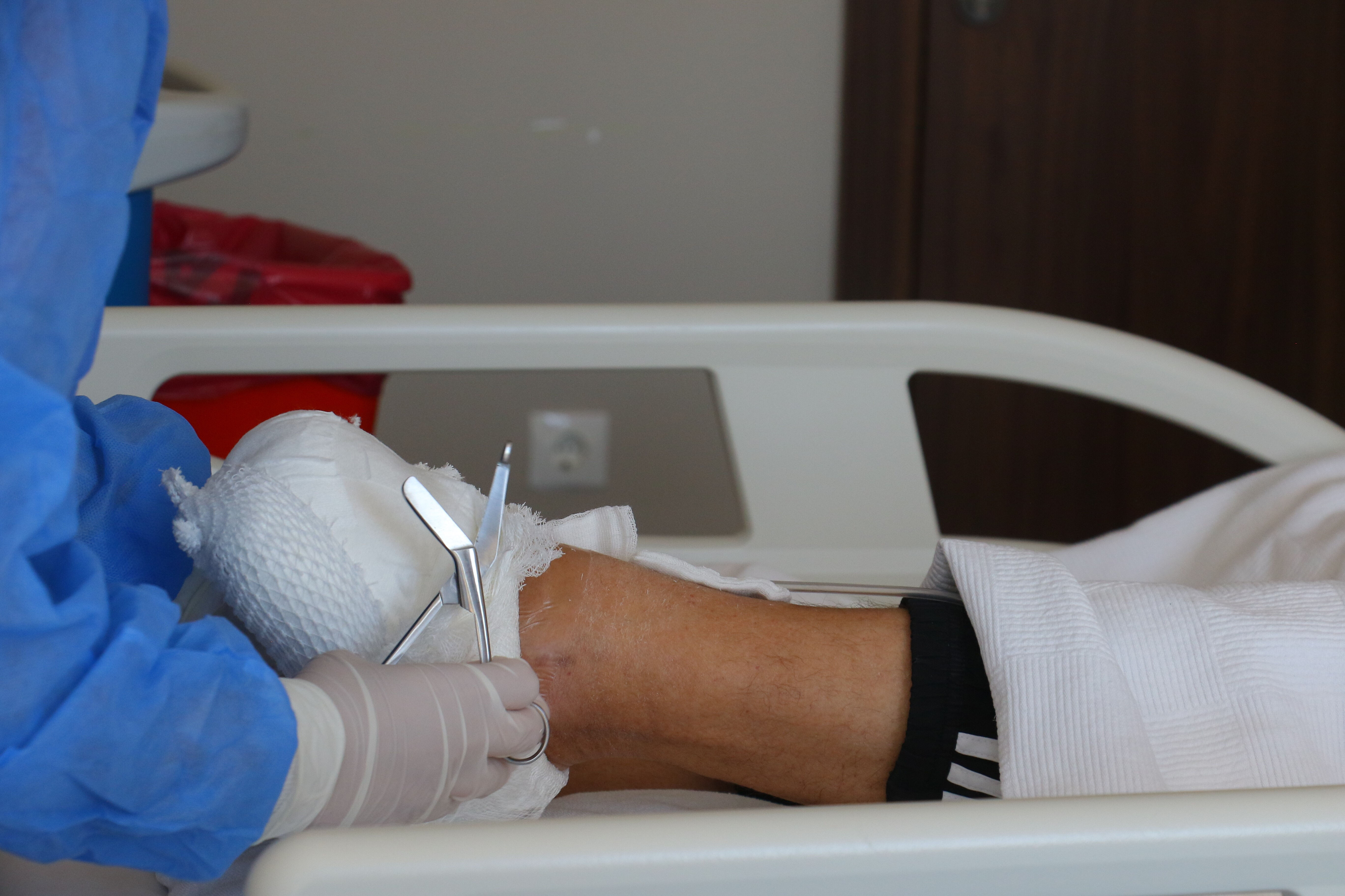 Yara sandı, ölümcül tehlike çıktı! Ayağını kurtaran o tedavi gündem oldu - 1. Resim