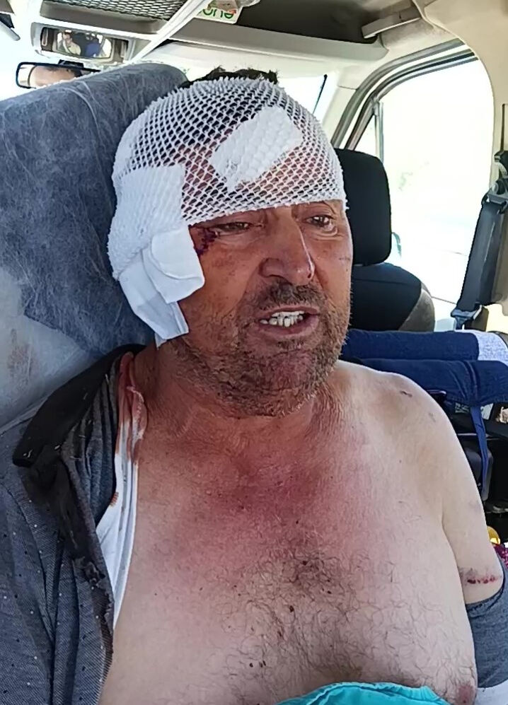 Aslan saldırısına uğrayan çiftçi ucuz kurtulmuş! Doktoru bile şoke oldu - 5. Resim