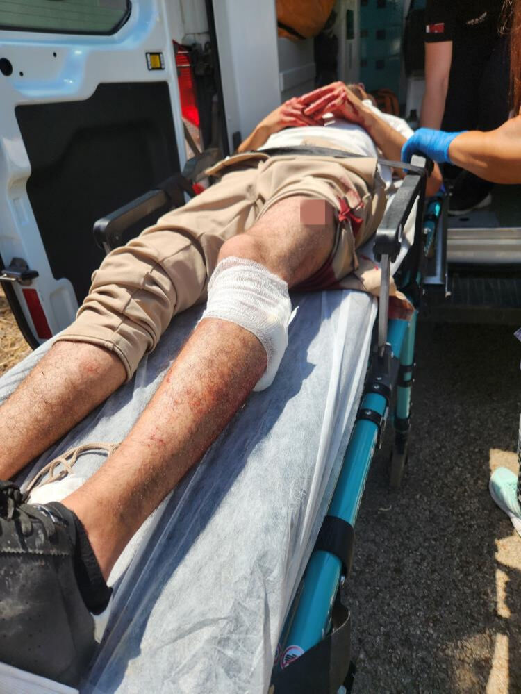 Antalya'da dehşet! Tartıştığı kişiyi bacağından vurup başında bekledi - 1. Resim