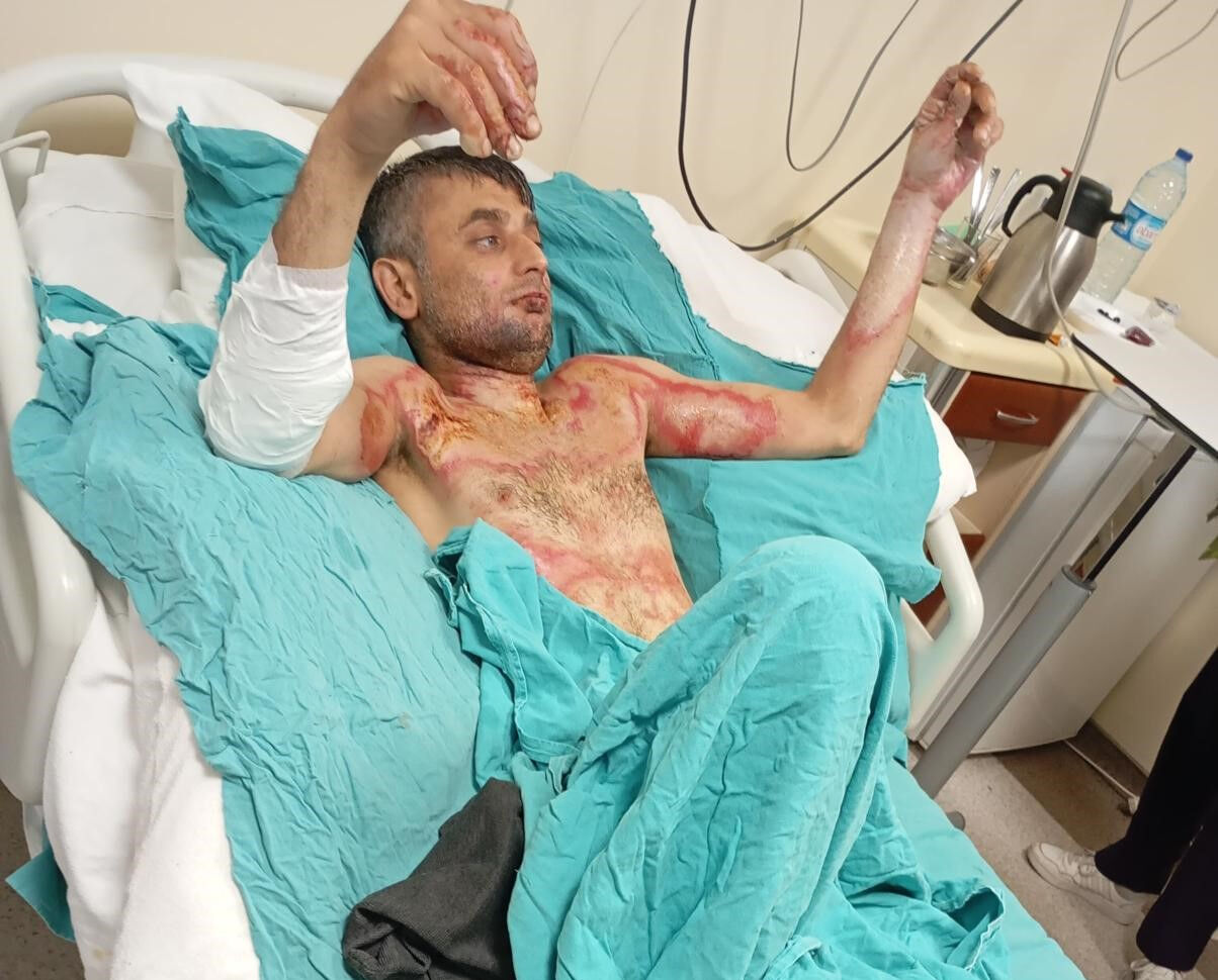 Gaziosmanpaşa'da dehşet olay! Engelli vatandaşı benzin döküp yaktı... Detaylar korkunç - 5. Resim