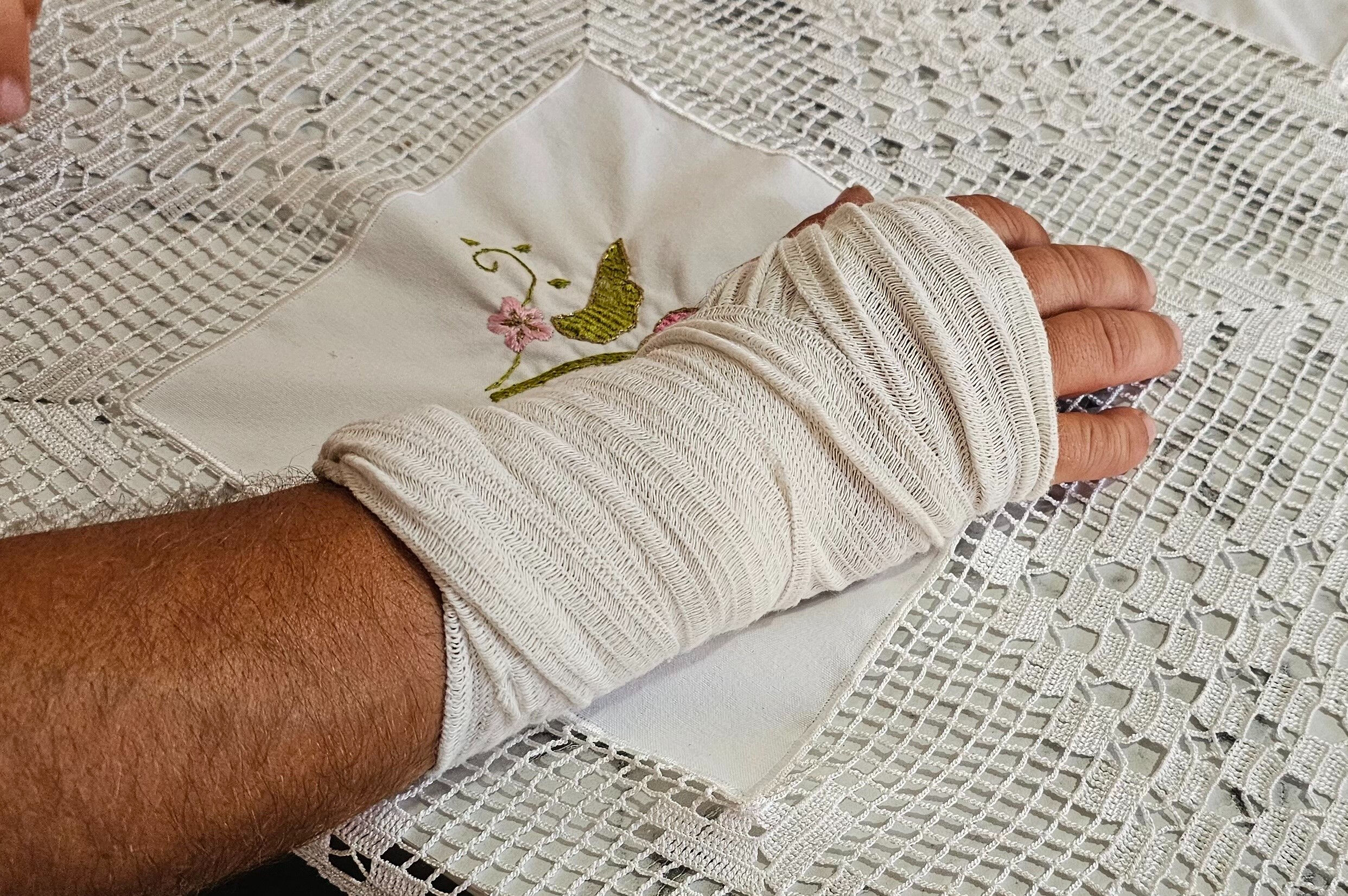 Sokak köpeği ayağını dakikalarca bırakmadı! Hem çatlak hem de kırık var - 2. Resim