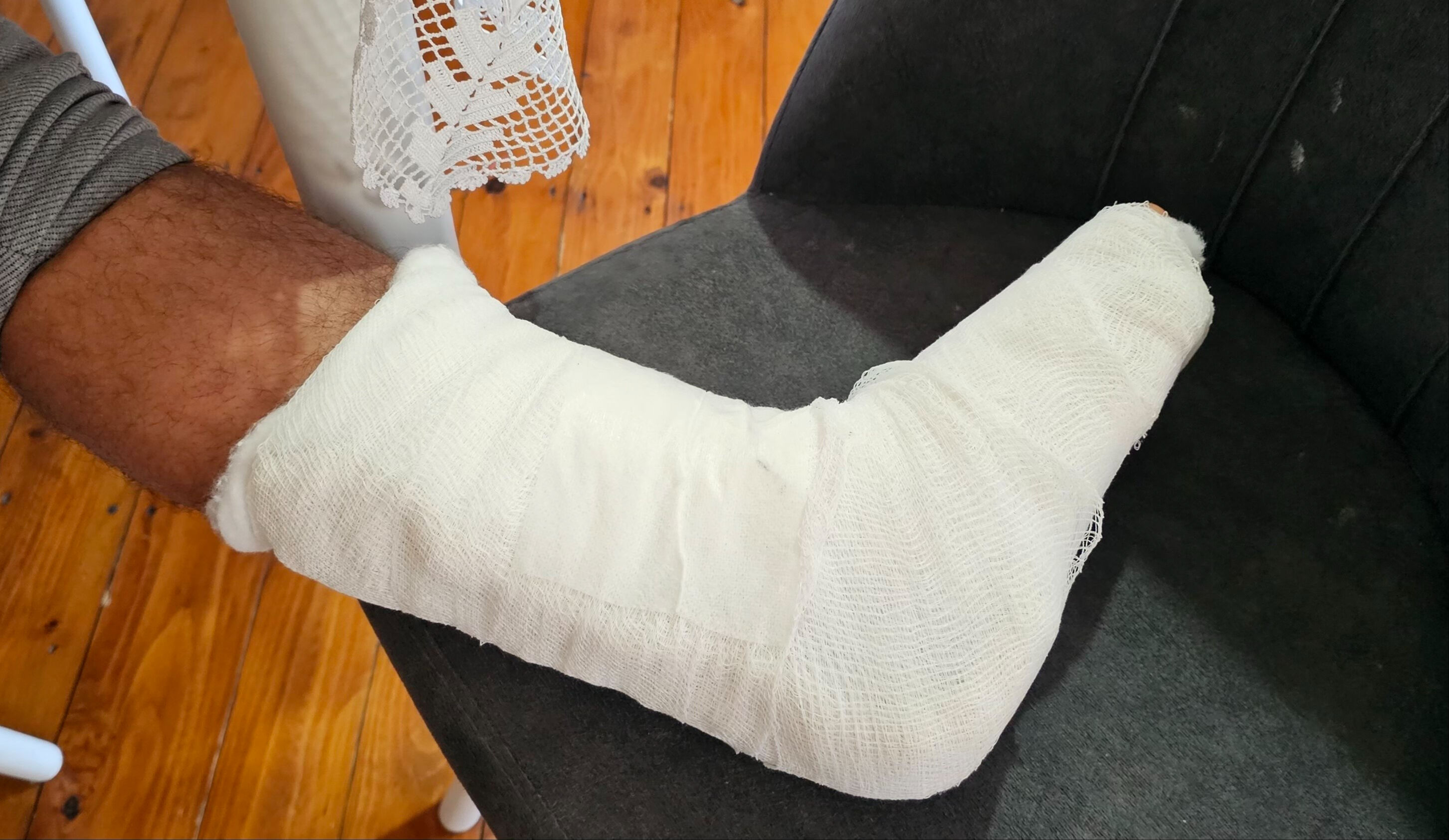 Sokak köpeği ayağını dakikalarca bırakmadı! Hem çatlak hem de kırık var - 1. Resim