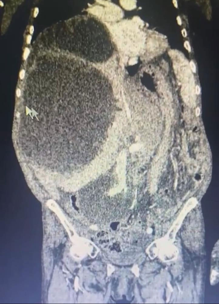 Ağrı ve şişlik şikayetiyle başvurdu! Meğer kedi köpekten bulaşmış, karnını doldurmuş - 3. Resim