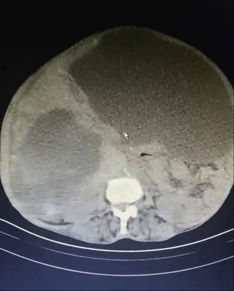 Ağrı ve şişlik şikayetiyle başvurdu! Meğer kedi köpekten bulaşmış, karnını doldurmuş - 2. Resim
