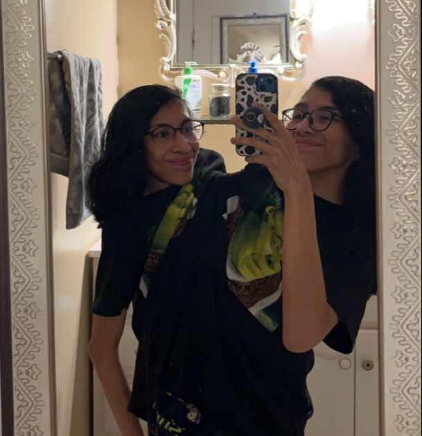 Herkes bunu konuşuyor! Yapışık ikizlerden biri evlendi, diğeri ise evlenmek istemiyor - 2. Resim