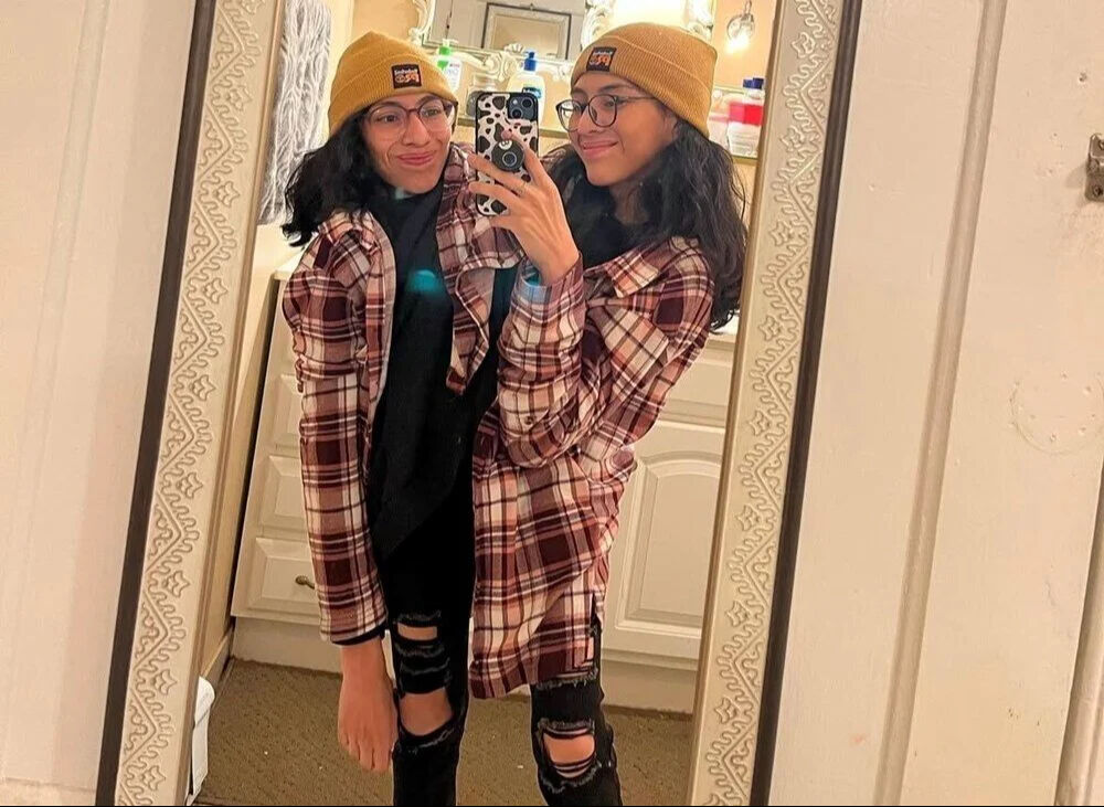 Herkes bunu konuşuyor! Yapışık ikizlerden biri evlendi, diğeri ise evlenmek istemiyor - 1. Resim