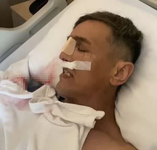 Aynı hastanede bir ay arayla ikinci ölüm! Ramazan Ak burun ameliyatından sağ çıkamadı - 1. Resim